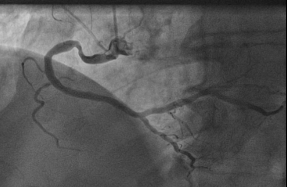 pierredeharo tweet media