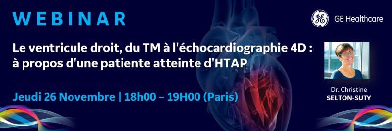 GE Healthcare vous invite à ce webinar sur: Le ventricule droit, du TM à l'échocardiographie 4D: à propos d'une patiente atteinte d'HTAP, présenté par le Dr Christine SELTON-SUTY, Cardiologue au CHRU de Nancy.
📆 Jeudi 26 Novembre à 18h00 Inscrivez-vous ! bit.ly/3eFmylu