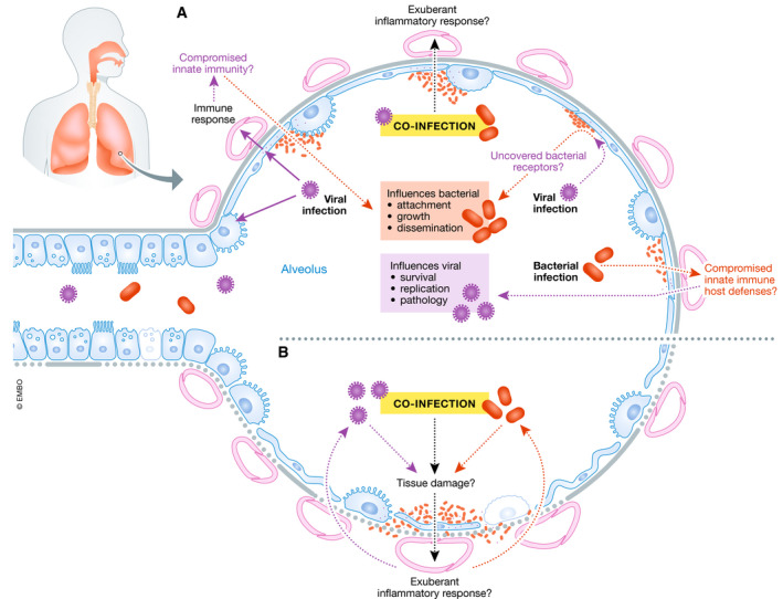 5/12 A viewpoint on "SARS‐CoV‐2, bacterial co‐infections, and AMR: the deadly trio in COVID‐19?" in  @EmboMolMed by Dr. Bengoechea and  @cggbamford  https://www.ncbi.nlm.nih.gov/pmc/articles/PMC7283846/