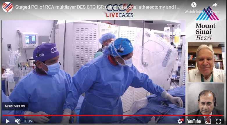 ccclivecases's tweet photo. Watch LIVE NOW and ask us your questions to our special guest faculty speaker:
@ron_waksman
https://t.co/lLZG6WvdPN
"Staged PCI of RCA Multilayer DES CTO ISR using Rotational Atherectomy and IVBT"
#pci #CTO #Rotationalatherectomy #IVBT #ISR #brachytherapy https://t.co/xiiT2dDIzJ