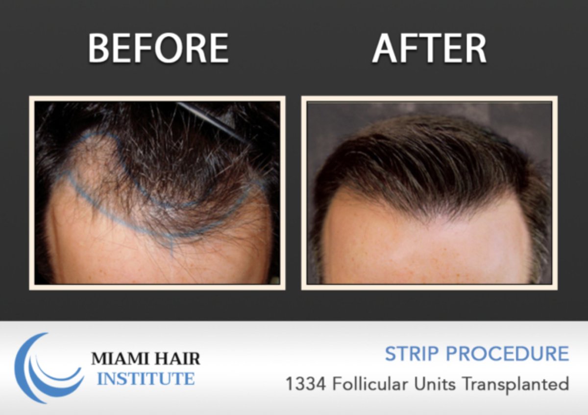 Miami Hair Institute (@Miami_Hair) / Twitter Miami Hair Institute (@Miami_Hair) / Twitter