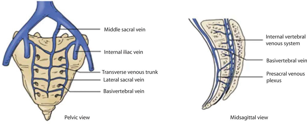 DCRjournal (@dcrjournal) on Twitter photo Treatment strategies for massive presacral bleeding - a #DCRJournal Resident's Corner - RT & let us know what you think! bit.ly/3nbna5r
<a href="/JohnRTMonsonMD/">John Monson MD FRCS FACS FASCRS</a> <a href="/jendavidsmd/">Jennifer Davids, MD</a> <a href="/ScottRSteeleMD/">Scott R. Steele</a> <a href="/Swexner/">Steven D Wexner MD, PhD</a> <a href="/me4_so/">SoMe4Surgery</a> <a href="/ACPGBI/">@ACPGBI</a> <a href="/drtracyhull/">Tracy Hull</a> <a href="/ASCRS_1/">ASCRS_1</a> Treatment strategies for massive presacral bleeding - a #DCRJournal Resident's Corner - RT & let us know what you think! bit.ly/3nbna5r
<a href="/JohnRTMonsonMD/">John Monson MD FRCS FACS FASCRS</a> <a href="/jendavidsmd/">Jennifer Davids, MD</a> <a href="/ScottRSteeleMD/">Scott R. Steele</a> <a href="/Swexner/">Steven D Wexner MD, PhD</a> <a href="/me4_so/">SoMe4Surgery</a> <a href="/ACPGBI/">@ACPGBI</a> <a href="/drtracyhull/">Tracy Hull</a> <a href="/ASCRS_1/">ASCRS_1</a>