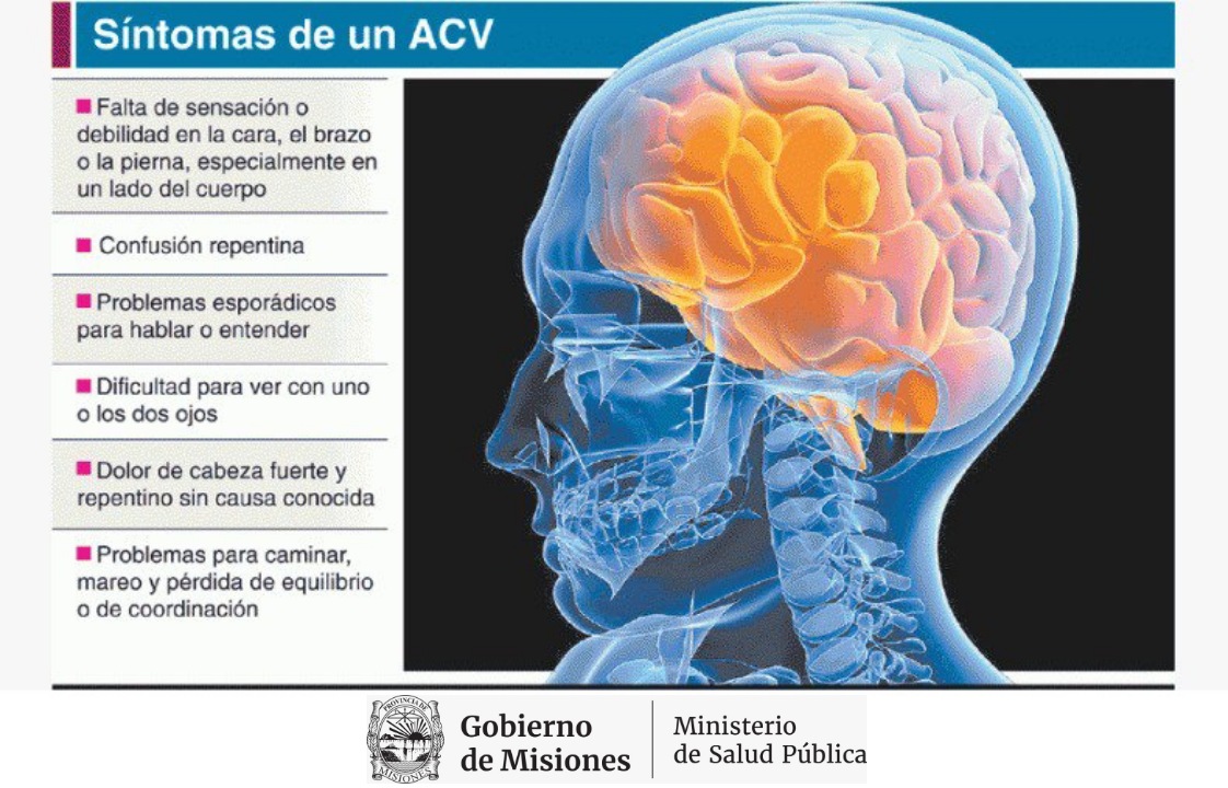 Menús para personas con ictus