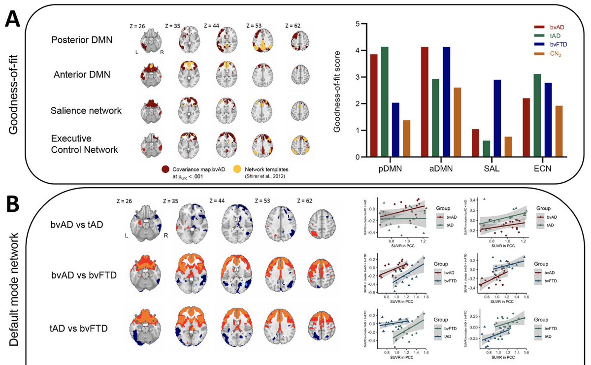 Beat_it_studie's tweet photo. Vers van de pers: onze groep toont patronen van hypometabolisme, connectiviteit, subcorticale atrofie en wittestofschade bij de gedragsvariant van #Alzheimer, een stap dichterbij het begrijpen van de neurobiologie van gedrag bij #Alzheimer @ZonMw @alzheimernl https://t.co/1uqQNcWLon