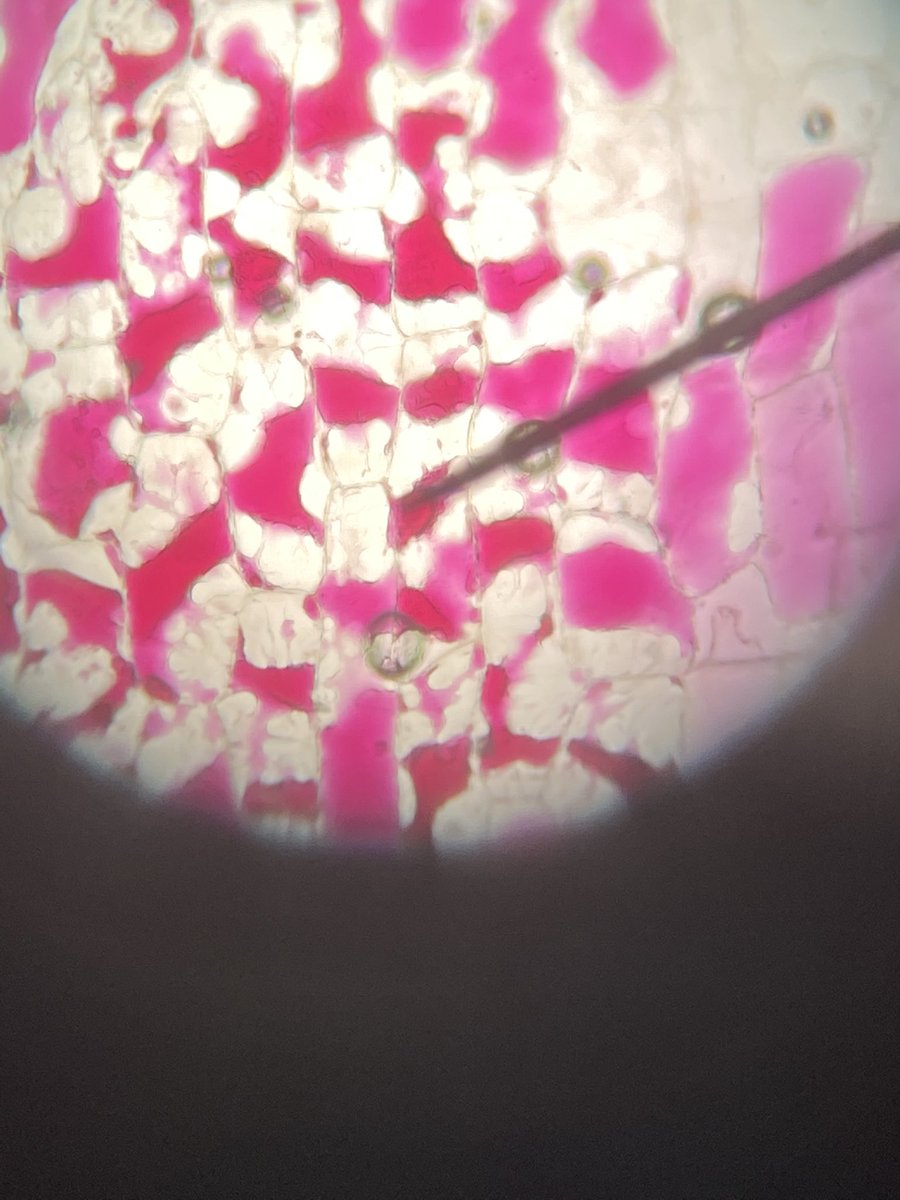 ScienceStrong's tweet photo. Before and after: using the air bubbles along the needle as a reference, you can see how the cells rehydrated once we replaced the salt water with distilled water #barkercsd https://t.co/w650WQiI9S