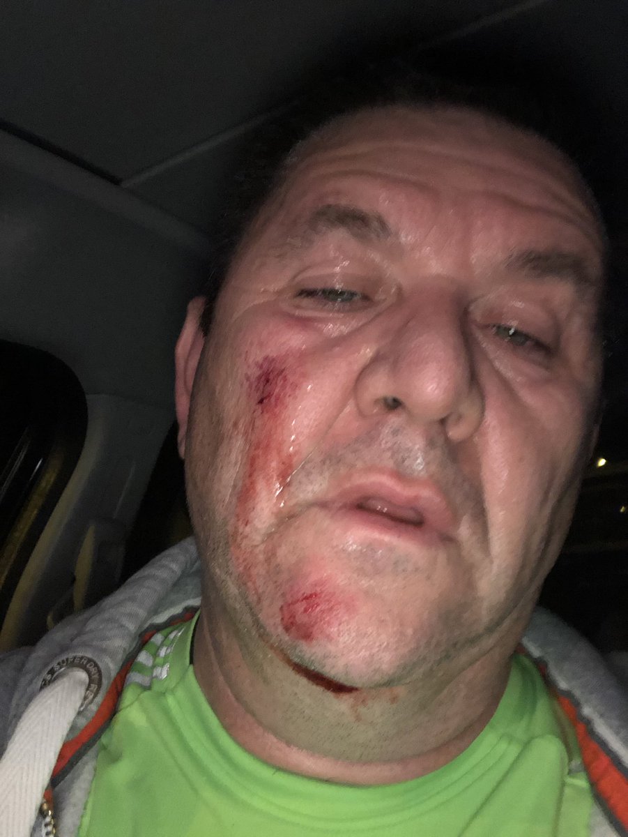 middpeter's tweet image. Well first time falling over while running 🏃🏻‍♂️🤕🥴but at least I completed the run.