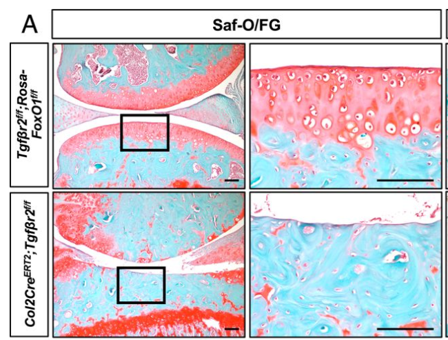 washu_ortho_res's tweet photo. Check out the new PNAS article by Regis O'Keefe and Jie Shen labs: FoxO1 is a crucial mediator of TGF-β/TAK1 signaling and protects against osteoarthritis… https://t.co/k3MUVPnATb 
@WUSTLortho @WUSTLdbbs @ors https://t.co/fqhsZ7Qoh5