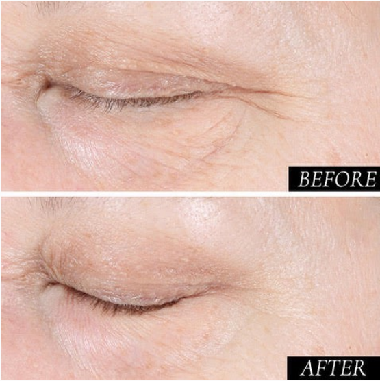 Look at these incredible results! After just two weeks, The  Diamond Contour Supercharged 1 Minute Daily Facial can make a world of difference! This potent formula addresses fine lines and wrinkles and enlarged pores, for a more glowing &amp; youthful complexion. ✨