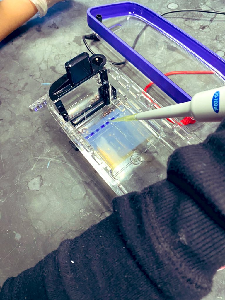 MrsAshlockCHS's tweet photo. Cohort B’s Gel Results.
Great work by all. 👏 👏
We now know whose blood 🩸 was left at the crime scene! #PLTW #PBS #biomed #handons #gelelectrophoresis 🧬 #room205 @CHS_Indians #SJSDProud https://t.co/gPXAcTpxPc