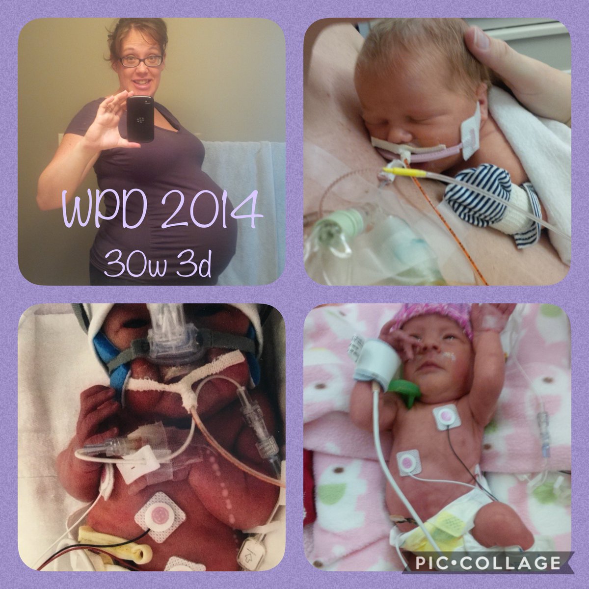 kendrabetes's tweet photo. How it started ๐ How itโs going
Go on with your bad selves, preemies of the world!!
#WorldPrematurityDay #WPD2020
#fightlikeapreemie #proudNICUmomma #32weekers #NICUgrads
@yyc_health @multiple_births @Cdn_Prem_Babies ๐๐๐ https://t.co/vRxTQ2yqZR