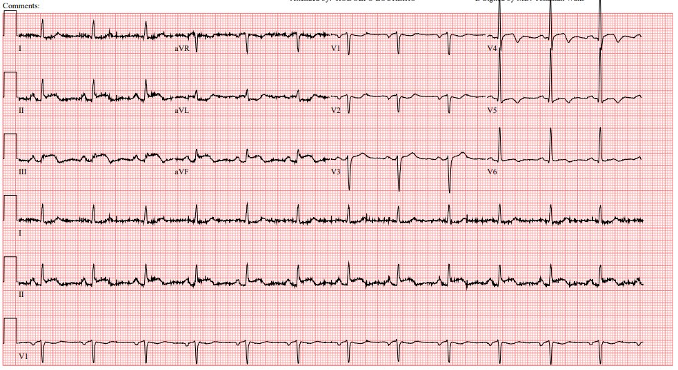 BID_CMRs's tweet image. #CODESTEMI!!! Which vessel are you worried about?