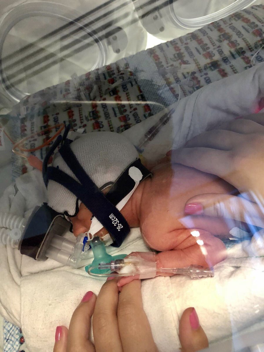 CLangford13's tweet photo. How it started: How it’s going: #WorldPrematurityDay2020 #WPDChallenge 💚 https://t.co/tjziBIqgPA