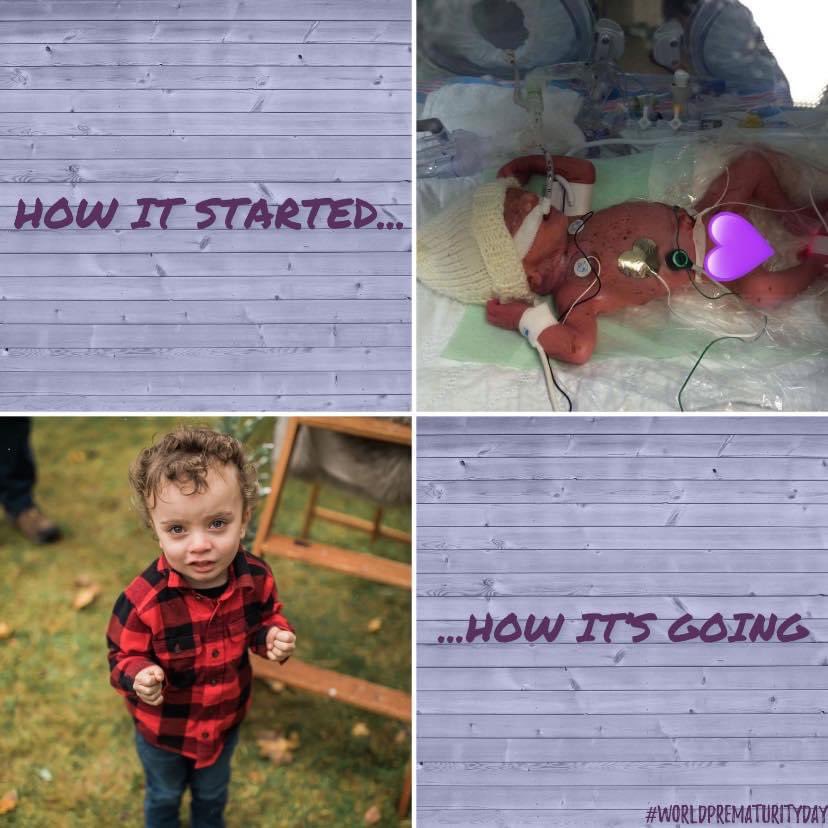 autistikait's tweet photo. From tiny to tornadoes. Once tiny, always strong.
Always thankful for the NICU at the @IWKHealthCentre for being there for these two when they needed them the most.
@IWKFoundation
#WPDChallenge #WorldPrematurityDay2020 #WorldPrematurityDay #mysuperheroeswearscrubs https://t.co/gGRIC2dFAb