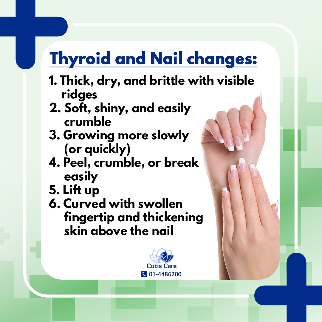 Causes of Brittle Nails - Diamond Skin Care