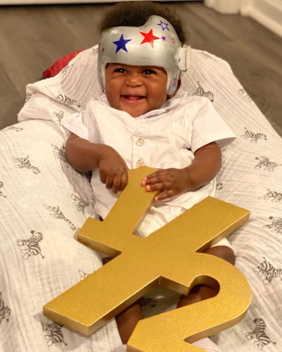 _FanmKreyol's tweet photo. Can’t get enough of him🥺😍 #torticollis #plagiocephaly #docband https://t.co/NepFIeBDdR