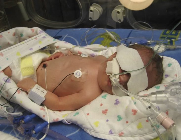 berferrie's tweet image. On #WorldPrematurityDay20 we remember the nurses who literally saved @FerrieHudson. Nurses are back in the news as covid rages &amp;amp; we know first hand they are worth their weight in gold. We couldn’t have imagined how he would thrive. #30wks #roughstart #fighterfromday1