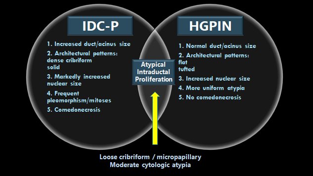 rovingatuscap's tweet image. This is an excellent question - I like to use a Venn Diagram for this (see pic) #GUpathJC #ProstateCancer #gupath