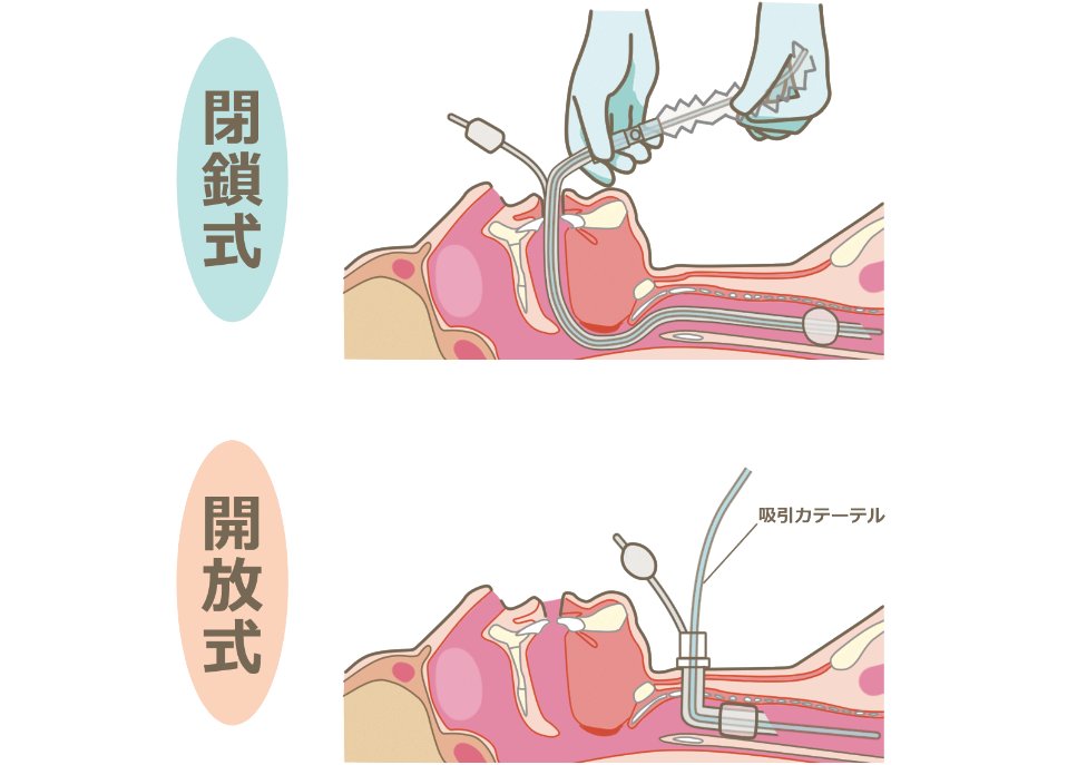 閉鎖式