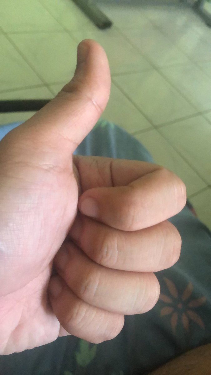 IvannValeriano's tweet photo. @kcmagnaye Thumbs up lang pre kaya ba? https://t.co/lBkRRIjTjd