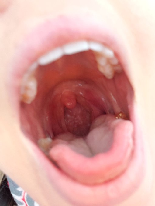 FEEEED MEEE!
#nerdyfaery #openmouth #vore #mouth #throat #fetish #fetishfriendly #tonguefetish https://t