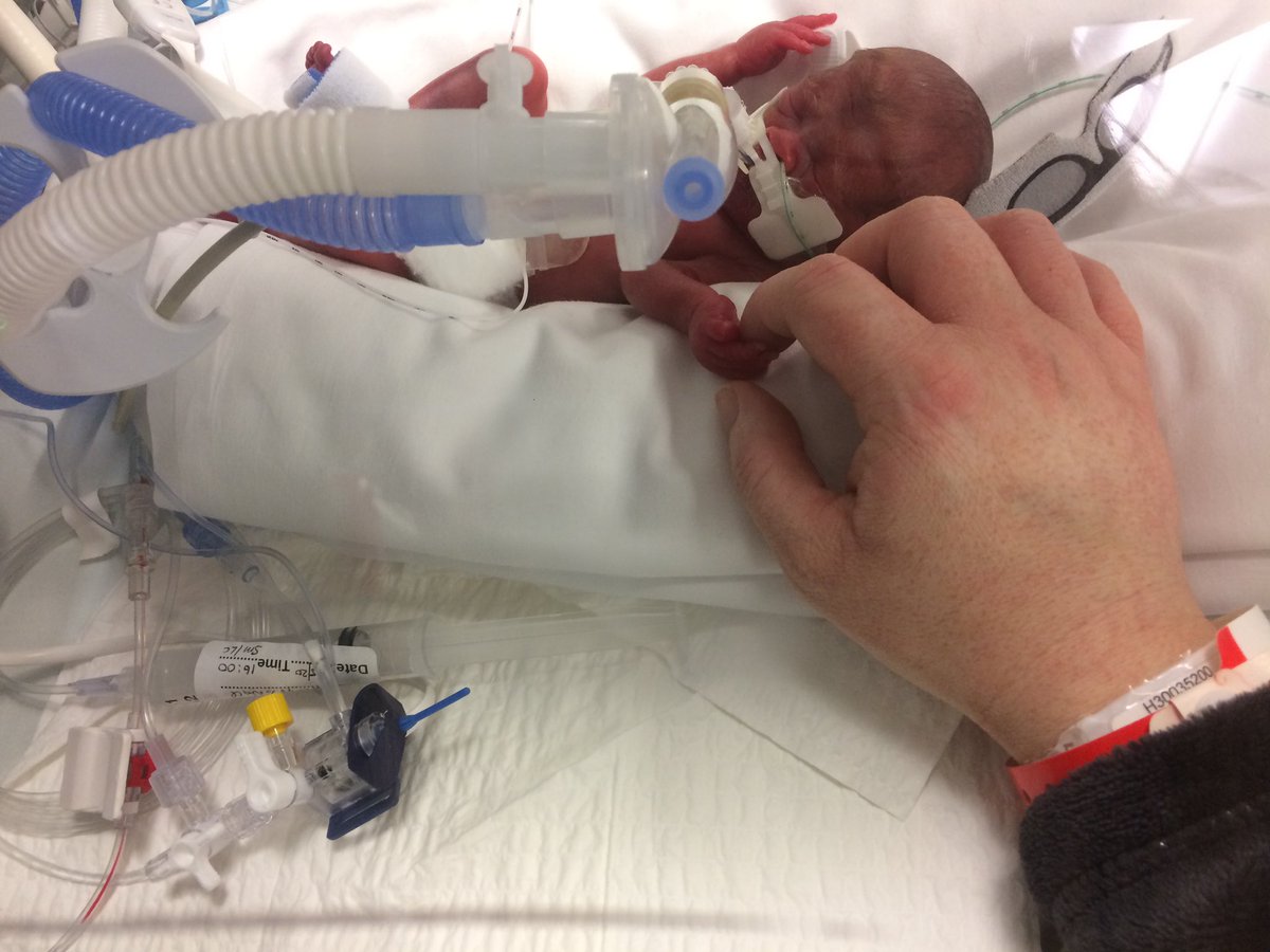 molly_perr's tweet photo. Thank you Deirdre @dlrcc for organising to acknowledge all hero preemies #borntosoon #WorldPrematurityDay2020
Louie 33 wk 4 Days due to Pre Eclampsia HELLP Syndrome now 4 yrs old & Spencer Peter 25 wk 4 days, who sadly passed away 7 days later 💙🦋 https://t.co/Mm9p09iVXJ