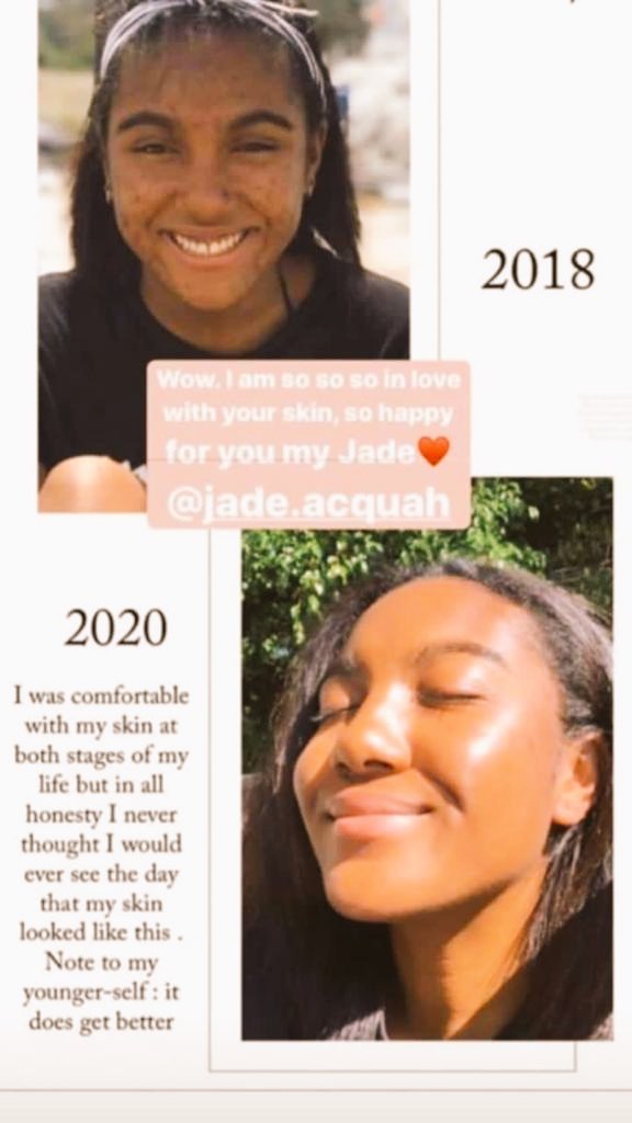kga9's tweet photo. #GirlBuyZA 
#DJSBU 
Order the soap and boost your confidence 

WhatsApp me @0718101763 https://t.co/wiM9xSwUuN