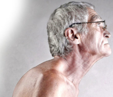 Failure to take action results in the development of Postural Kyphosis. Which is difficult to recover without invasive spinal surgery