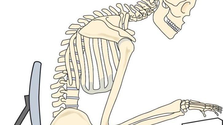 Reversing the damage of the modern lifestyle: Upper Crossed Syndrome A THREAD