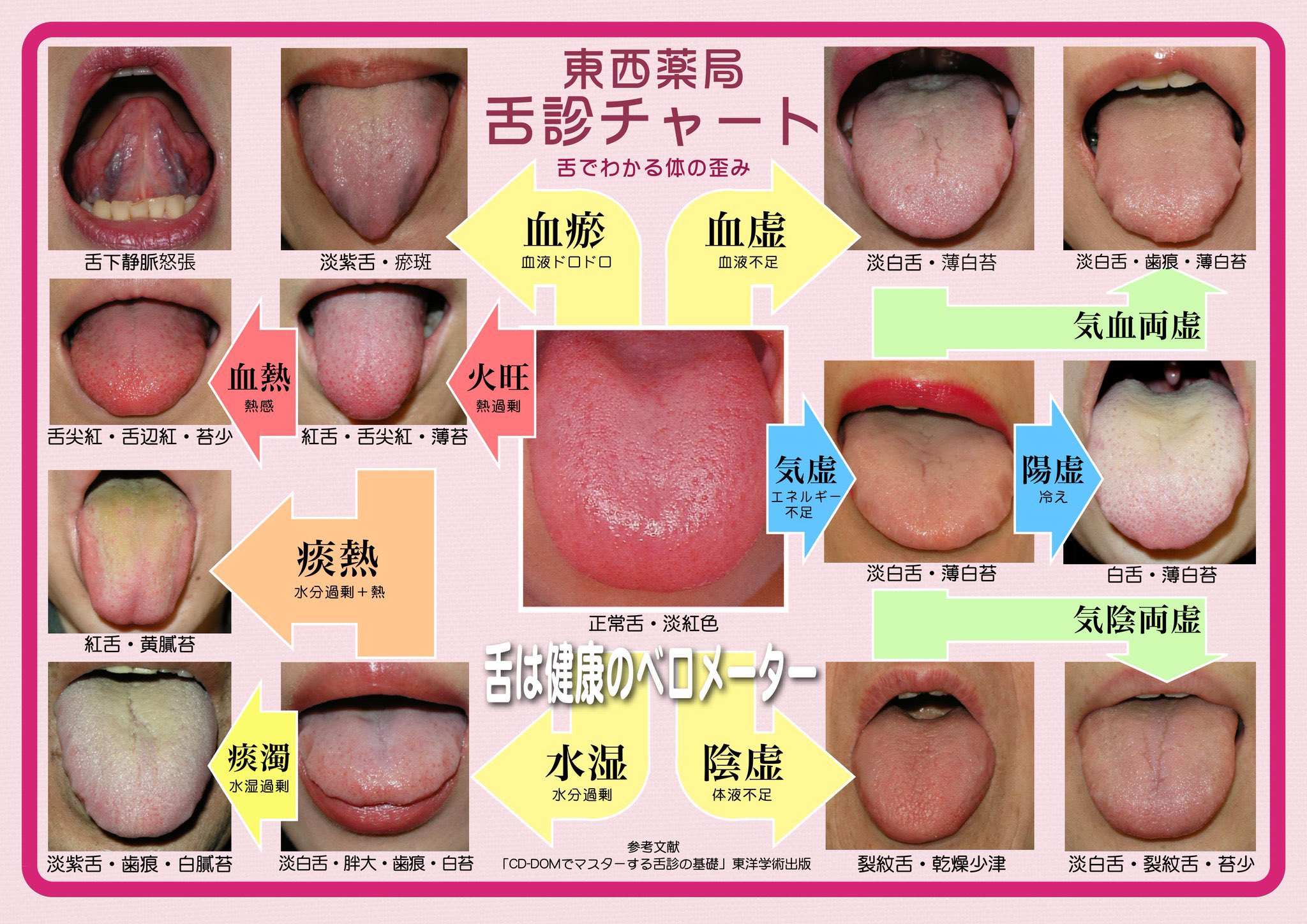 やわらかさん 不妊 不育症 Fumimi Chan 体調が舌に出やすいみたいです でも自分の舌がどういう状況なのかは素人にはよくわかんないですね Twitter