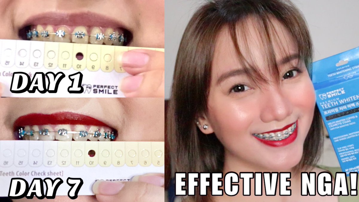 ERRKALIM's tweet photo. Hey #FAMILIMSQUAD!✨

NEW VIDEO is now up on my channel! ⬇️⬇️⬇️

HOW TO GET WHITER TEETH IN JUST 7 DAYS! 😲😁 (PERFECT SMILE REVIEW)
Link: https://t.co/b52fBsHwTv

Hope you guys watch it and don't forget to LIKE, SHARE and SUBCRIBE!

Thank you so much and keep safe y'all! 😊 https://t.co/zq8nTm0G3b