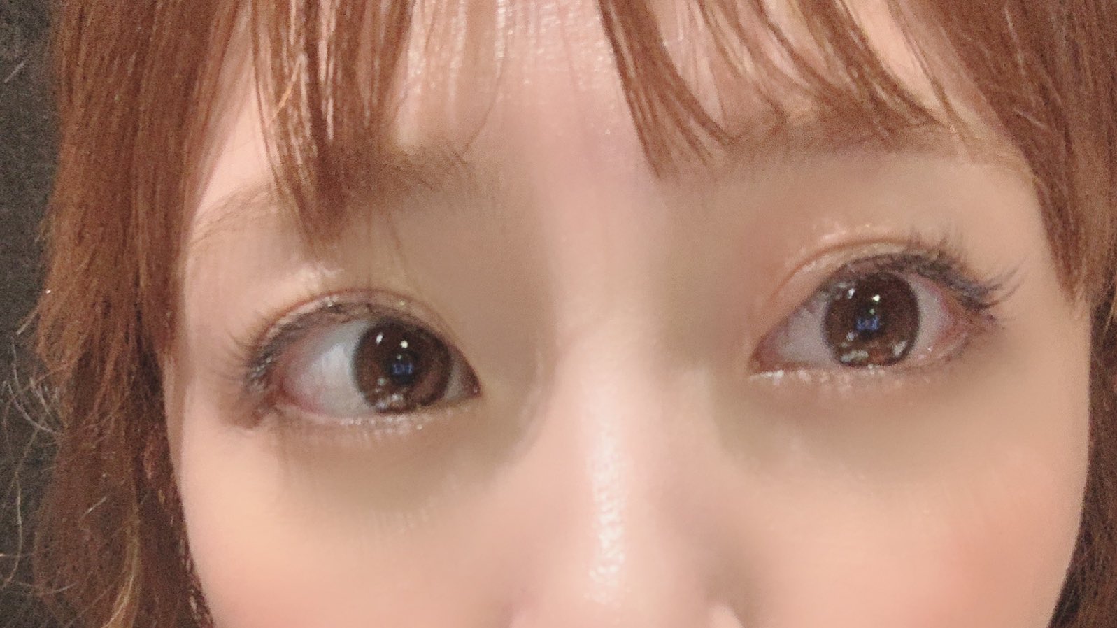 高橋みなみ 右目なんか腫れてるんだけど かゆい ものもらいじゃない事を祈る 多分虫刺され 高橋みなみ 右目なんか腫れてるんだけど かゆい ものもらいじゃない事を祈る 多分虫刺され