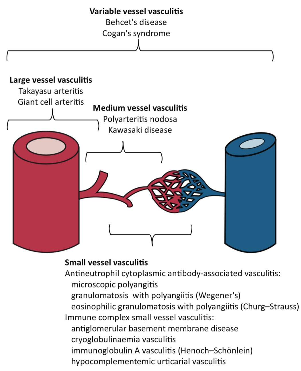 kawasaki arteritis