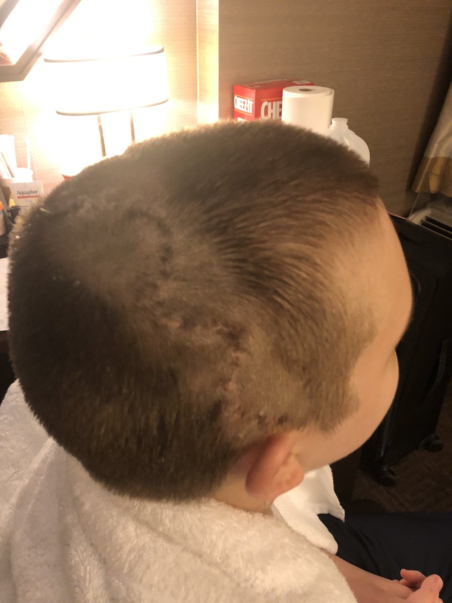 Hard to believe it’s been over a week already since Tyler’s surgery. His incision is healing better than imagined, swelling is less each day and pain is manageable by pretty much Tylenol/Ibuprofen only now. First follow up appointment is scheduled for Thursday. #TeamTyler #EndNF