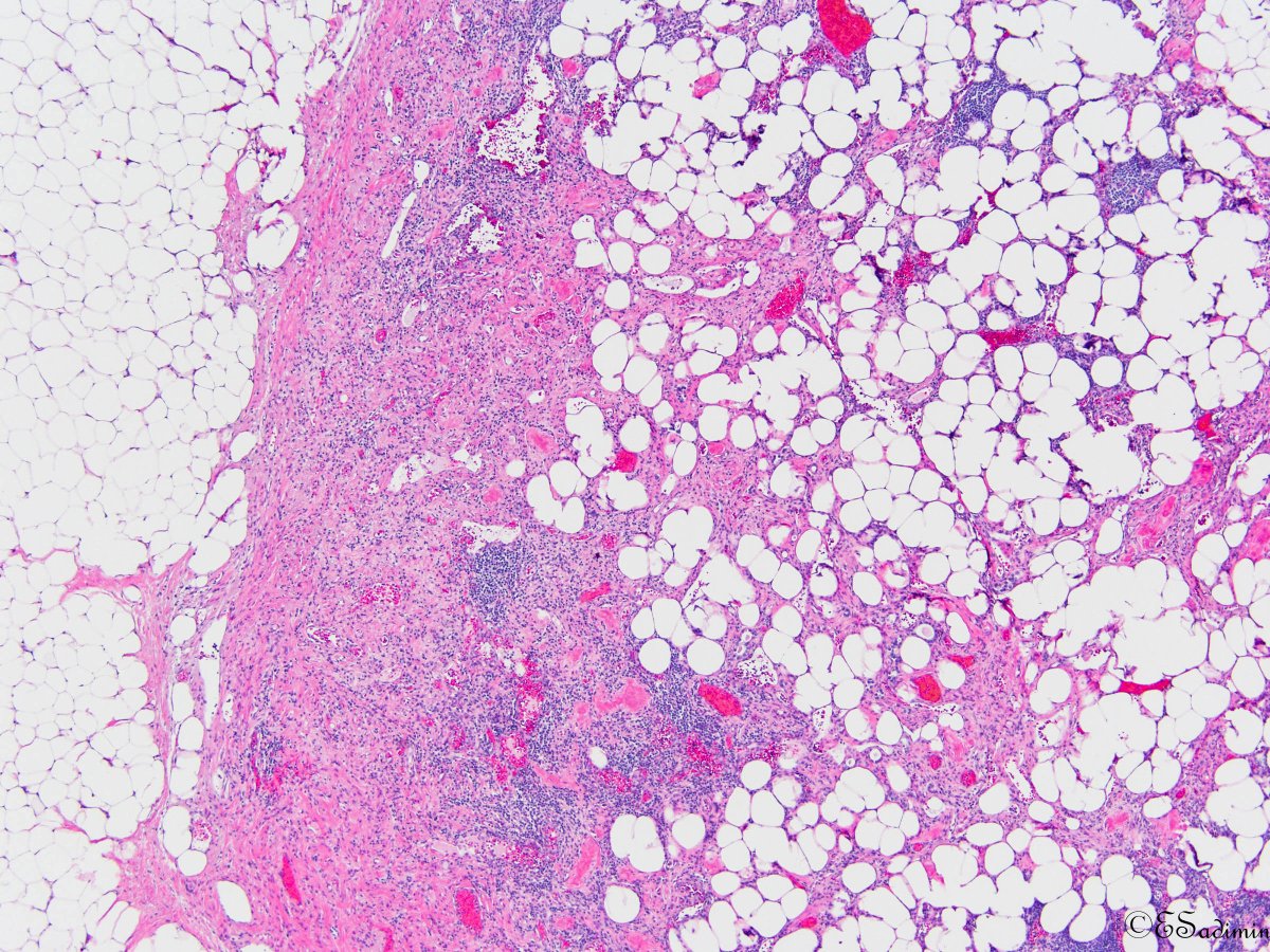 Evita Sadimin tweet media