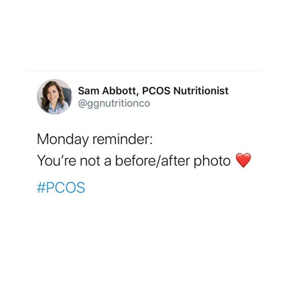 joinwana's tweet photo. Monday reminder: you're not a before/after photo 🤍

photo cred: @pcos.nutritionist

#chronicillness #chronicillnesswarrior #invisibleillnesswarrior #invisibleillness #spoonie #spoonievillage #sick #butyoudontlooksick #health #healing #healingjourney #community #joinwana #weare https://t.co/t5pxl9wcSs
