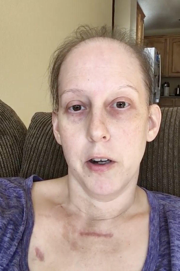 Going through cancer