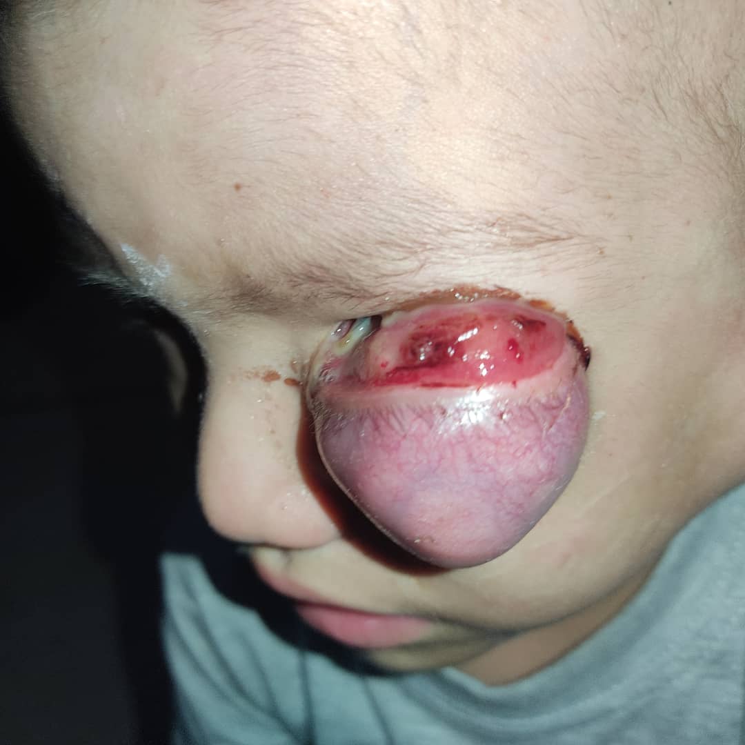#18Nov (Lamento lo dura de la foto pero necesita ayuda)| Jhonathan Rengel, de 3 años fue diagnosticado: Rabdomiosarcoma embrionario y, requiere ayuda económica para sus gastos.  01020346510106636398. Odalis Montilla. 19956002 Zelle: JOAOTELO
jtelo@me.com #LosBuenosSomosMa