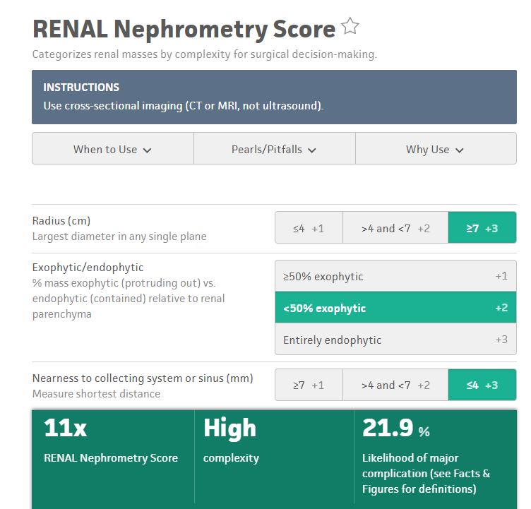 drahmetsahan's tweet photo. Laparoscopic partial nephrectomy for 11x R.E.N.A.L. score (82 mm)
⏱️WIT: 18 min ⏱️Total operation time: 130 min.
👉Blood loss: 240 ml
Full video link 👉https://t.co/Chb6j4KiOO
#UroSoMe #laparoscopy #nephrectomy #nephronsparing https://t.co/dW6WaqAOzj