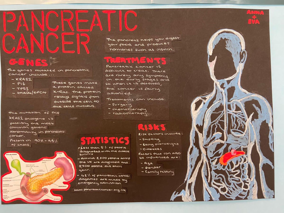 AcademyLargs's tweet photo. Some fantastic posters showcasing cancer research by the advanced higher biology class!
#advancedbiology
#teamwork
#medicinalresearch https://t.co/4ygyysl2D2