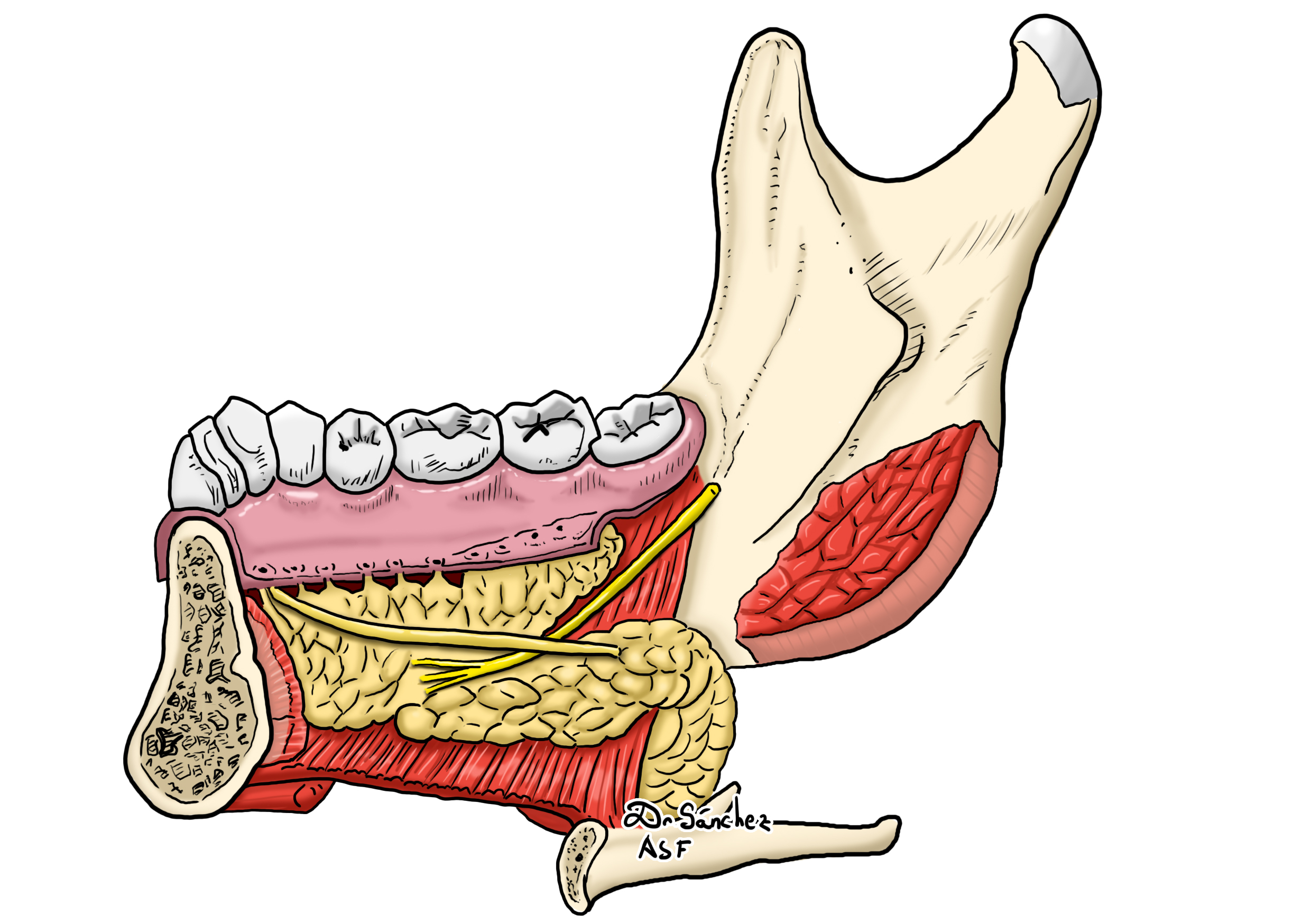 Drenaje de la glándula sublingual 