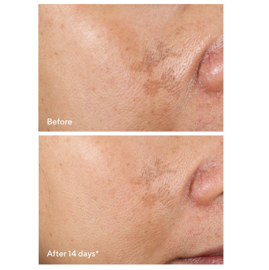 Introducing NEW Rapid Dark Spot Correcting Serum! 🎉 Rapidly reduce the look of dark spots without a doctor's visit. This serum promotes surface cell turnover for brighter, more even skin. 84% saw a reduction in the look of dark spots in 14 days. bit.ly/36Js2Z8