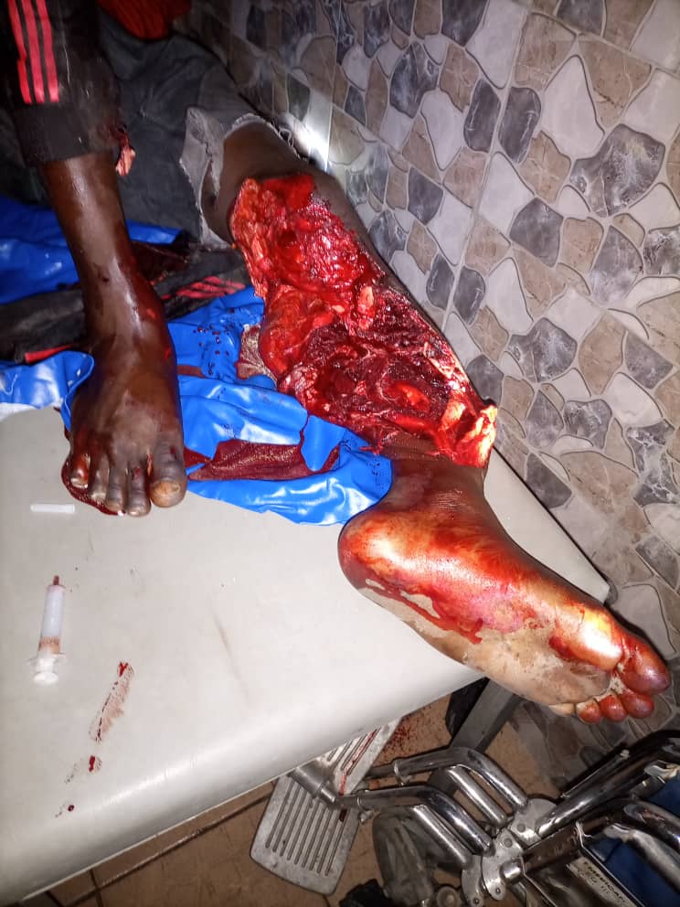 Please pray for my cousin to survive this wickedness.  God I need you now more than before. My cousin had an accident 😭😭😭😭😭😭