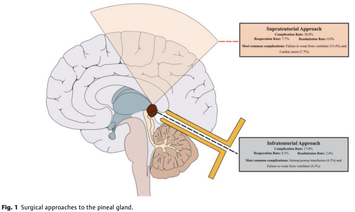 #JNLSB_Classic
Supratentorial and Infratentorial Approaches to Pineal Surgery: A Database Analysis
#nsgy #pineal #skullbase #complexcranial #Approaches #SCIT #NASBS
thieme-connect.com/products/ejour…