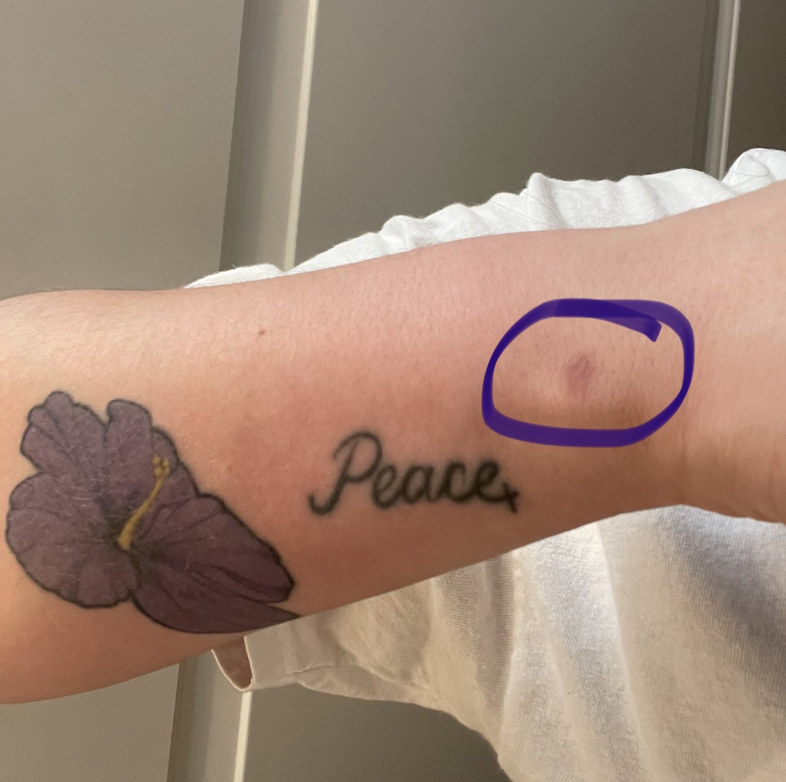 Jess on X: "Beyond pleased to report that if you burn yourself on the  inside of the oven it will definitely leave a scar after the burn heals.  https://t.co/35x3M6R91R" / X