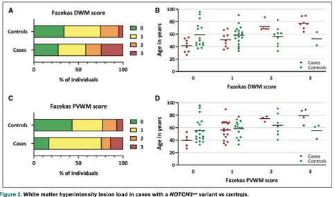 Dr. Vida Abedi, PhD (@vida_abedi) on Twitter photo Medical records incl brain MRI were evaluated for clinical and neuroimaging findings associated with small vessel disease. Powerful population-based study using #MyCode ahajournals.org/doi/10.1161/ST⦠<a href="/StrokeAHA_ASA/">Stroke AHA/ASA</a> <a href="/RaminZand1/">Ramin Zand</a> <a href="/DecodeLab/">theDecodeLab</a> <a href="/jiangli92750983/">jiang li</a> @cgriessenauer <a href="/GeisingerRsrch/">Geisinger Research</a> Medical records incl brain MRI were evaluated for clinical and neuroimaging findings associated with small vessel disease. Powerful population-based study using #MyCode ahajournals.org/doi/10.1161/ST⦠<a href="/StrokeAHA_ASA/">Stroke AHA/ASA</a> <a href="/RaminZand1/">Ramin Zand</a> <a href="/DecodeLab/">theDecodeLab</a> <a href="/jiangli92750983/">jiang li</a> @cgriessenauer <a href="/GeisingerRsrch/">Geisinger Research</a>
