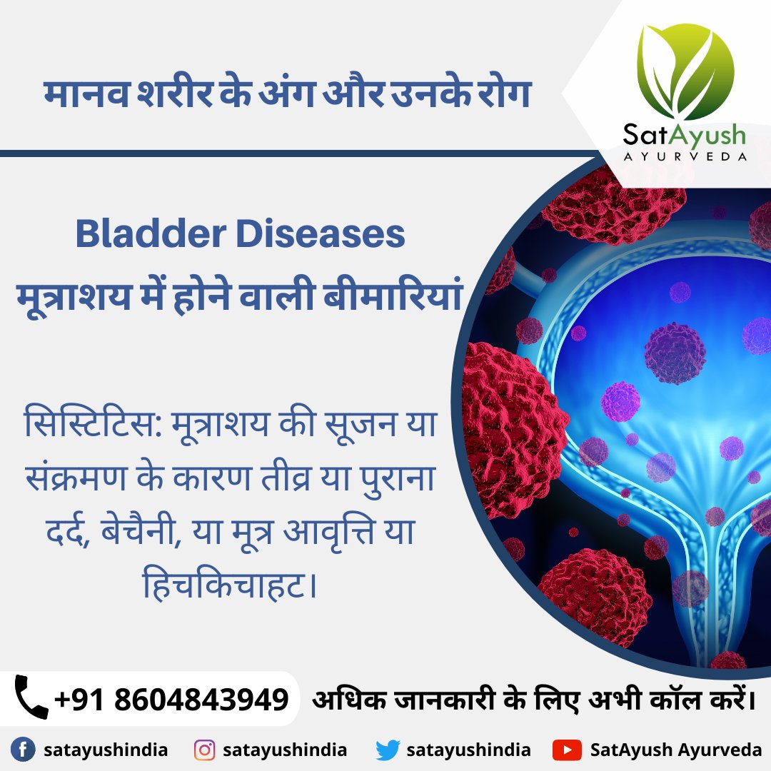 satayushindia's tweet photo. Parts of the #humanbody and their #diseases:-
#Bladderdiseases -
#Cystitis: #Bladderinflammation or #infection causes acute or #chronicpain, #discomfort, or #urinaryfrequency or #hesitation.
#satayush #satayushayurveda #natural #ayurveda #ayurvedic #healthylife #ayurvedaforyou https://t.co/uEuldIy2HM