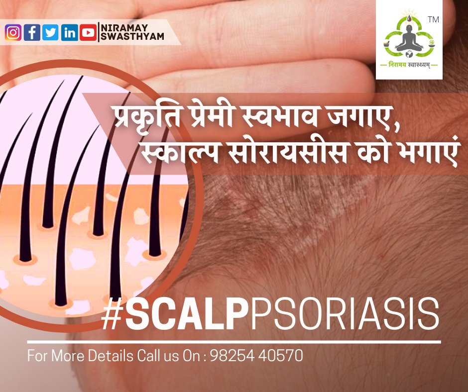 आपका स्काल्प सोरायसिस ठीक हो सकता है।
प्राकृतिक ट्रीटमेंट से. . .

#scaleonscalp #psoriasisayurvedicoil #psoriasisshampoo #scalppsoriasis #psoriasisdiet #BestAyurvedDr #BestAyurvedClinicinGujarat #BestAyurvedClinicinIndia #NishulkAyurvedClinic #TopestAyurvedDr #Psoriasis