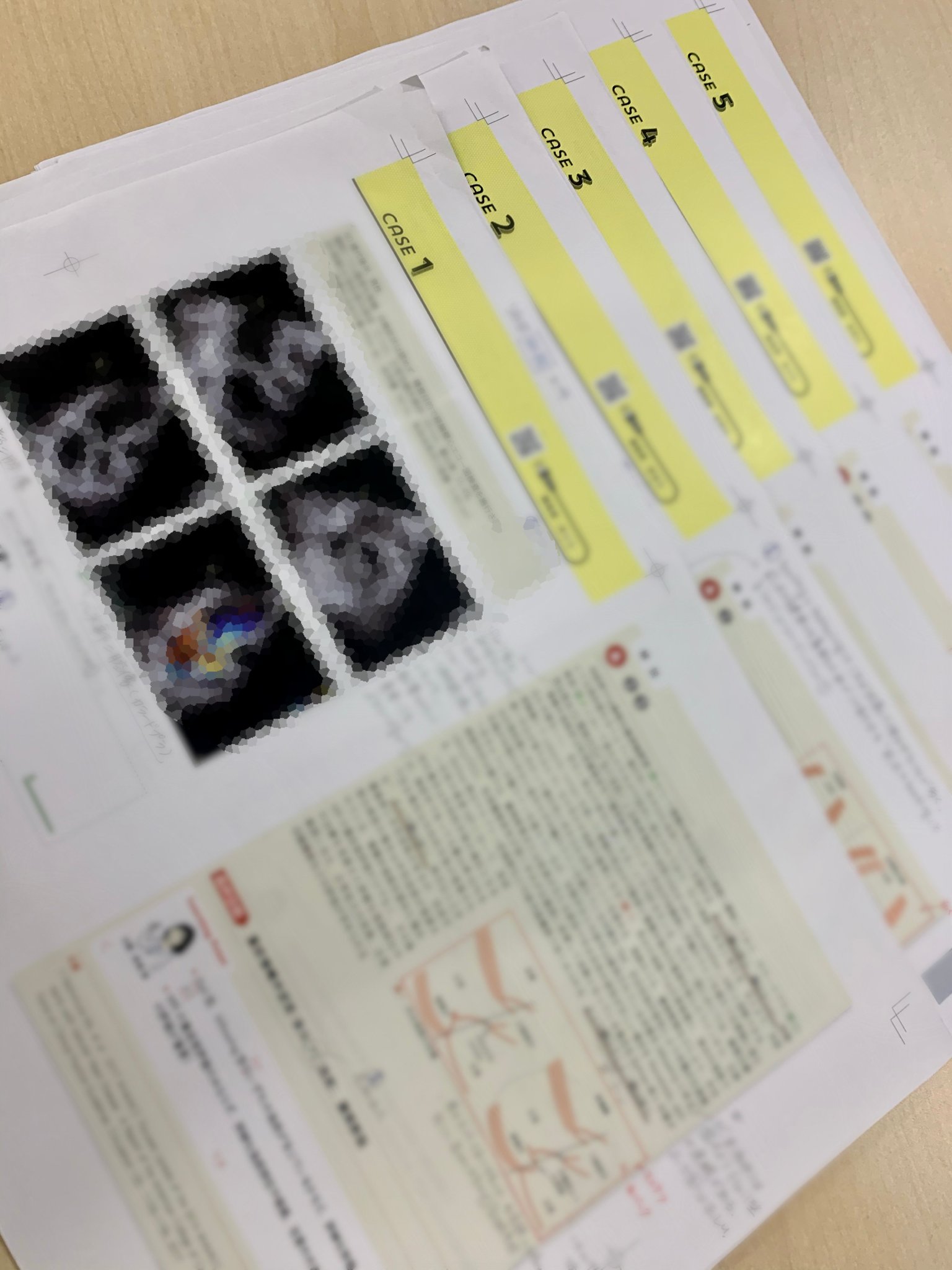 エコドリ セザ本 担当編集 医学書院 循環器ジャーナル で連載しておりました 心エコーのドリル企画 ついに書籍版のゲラが出始めました 雑誌連載から大幅にパワーアップしてお届けする予定で 循環器の先生はもちろん 研修医の方や 超音波検査士の エコドリ セザ本 担当編集 医学書院 循環器ジャーナル で連載しておりました 心エコーのドリル企画 ついに書籍版のゲラが出始めました 雑誌連載から大幅にパワーアップしてお届けする予定で 循環器の先生はもちろん 研修医の方や 超音波検査士の