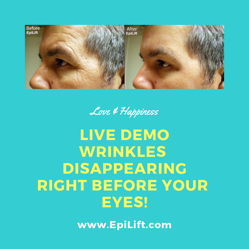 EpiLiftIntl's tweet photo. Christmas time is right around the corner.  Make Money selling popular instant face lift cream fast @ https://t.co/DozvwZkXUc

#Entrepreneur #businessowner #businessopportunity #wrinkles #eyes #face #results https://t.co/PLl98FpaEl