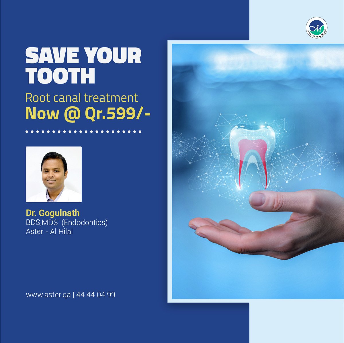 asterdmhqatar's tweet photo. Keeping your tooth helps to prevent your other teeth from drifting out of line and causing jaw problems. Save your tooth with root canal treatment @ Qr.599/- at Aster Medical Centre - Al Hilal. https://t.co/OO9UFV0c6P